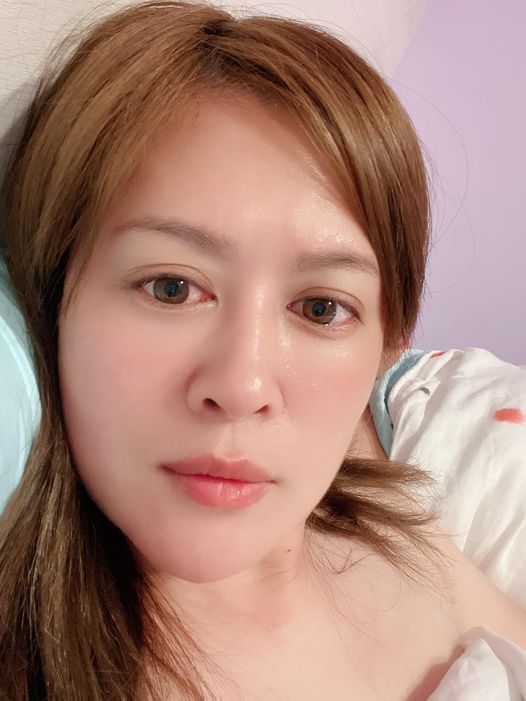 【肉毒桿菌】自強星和診所（竹北）- 林明潔醫師-定期進廠保養，保持肌膚好狀態！！！！～-如宣